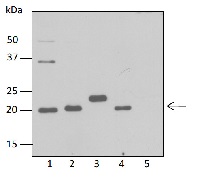 pClpP | Chloroplastic ATP-dependent Clp protease proteolytic subunit 1 in the group Antibodies Plant/Algal / Photosynthesis / Proteases at Agrisera AB (Antibodies for research) (AS15 3077)